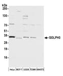 Detection of human and mouse GOLPH3 by western blot.