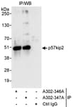 Detection of human p57kip2 by western blot of immunoprecipitates.