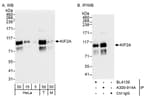 Detection of human and mouse KIF2A by western blot (h&amp;m) and immunoprecipitation (h).