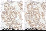 Detection of human eIF6 by immunohistochemistry.