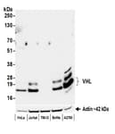 Detection of human VHL by western blot.