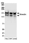 Detection of human Kinectin by western blot.