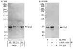 Detection of human Cry2 by western blot and immunoprecipitation.