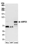 Detection of human AMPD3 by western blot.