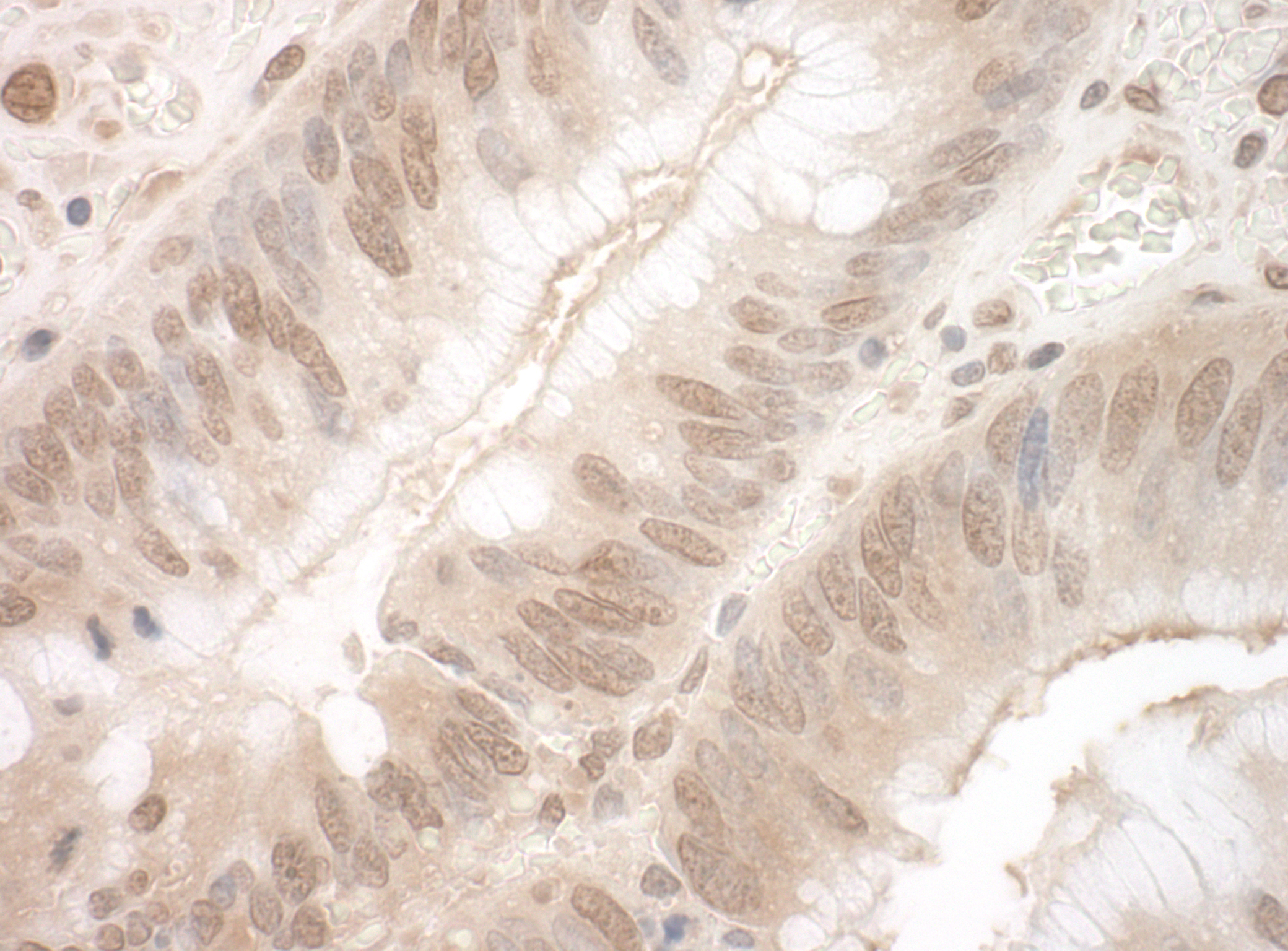Rabbit anti-EYA3 IHC Antibody