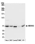 Detection of human and mouse MEKK3 by western blot.