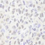 Detection of mouse Pds5B by immunohistochemistry.