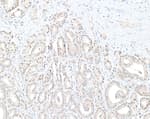 Detection of human DTL/CDT2 by immunohistochemistry.