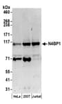 Detection of human N4BP1 by western blot.