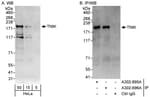 Detection of human TNIK by western blot and immunoprecipitation.