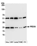 Detection of human and mouse PRDX6 by western blot.