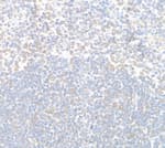 Detection of TPR by immunohistochemistry.