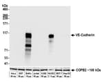 Detection of human VE-Cadherin by western blot.