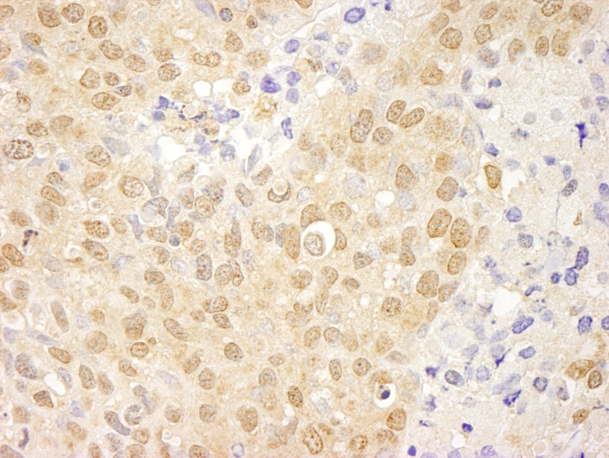 Detection of human cAbl by immunohistochemistry.