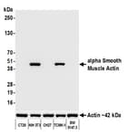 Detection of mouse alpha Smooth Muscle Actin by western blot.