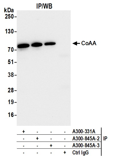 Detection of human CoAA by western blot of immunoprecipitates.