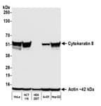 Detection of human Cytokeratin 8 by western blot.