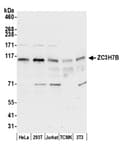 Detection of human and mouse ZC3H7B by western blot.
