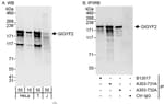 Detection of human GIGYF2 by western blot and immunoprecipitation.