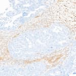 Detection of human CD90/Thy1 by immunohistochemistry.