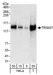 Detection of human TRIM37 by western blot.