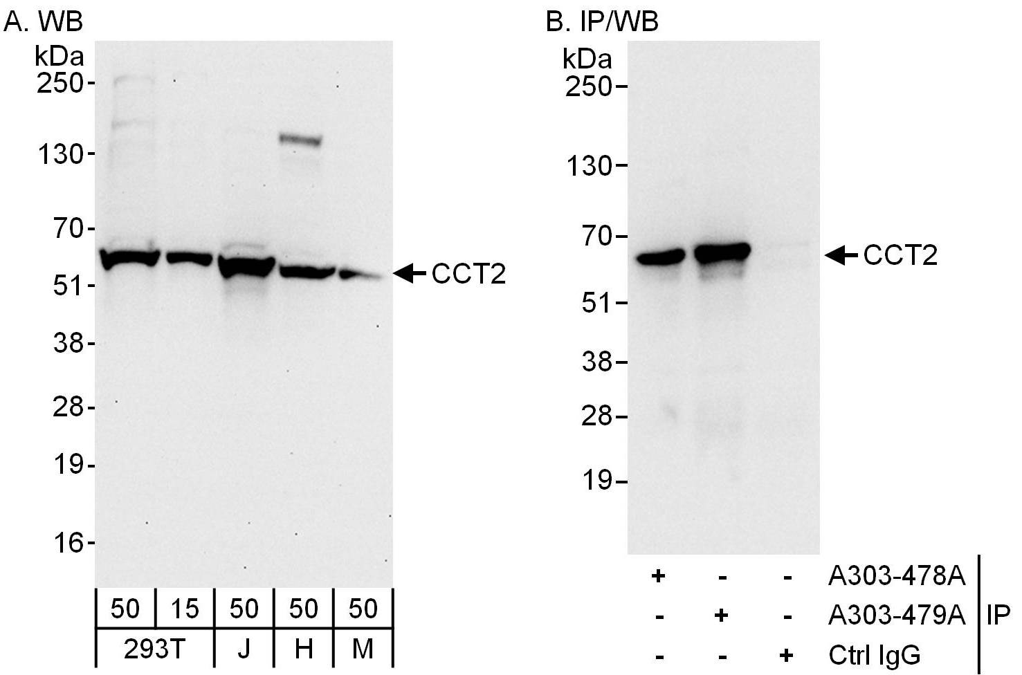 Detection of human and mouse CCT2 by western blot (h and m) and immunoprecipitation (h).