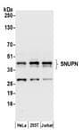 Detection of human SNUPN by western blot.