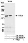 Detection of human FANCA by western blot of immunoprecipitates.