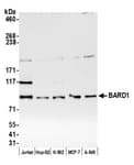 Detection of human BARD1 by western blot.