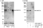 Detection of human ANKS1A by western blot and immunoprecipitation.