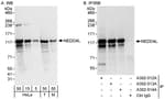 Detection of human and mouse NEDD4L by western blot (h&amp;m) and immunoprecipitation (h).