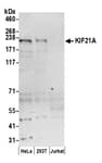 Detection of human KIF21A by western blot.