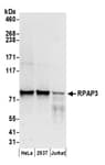 Detection of human RPAP3 by western blot.