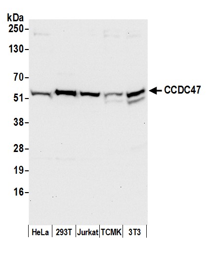 Detection of human and mouse CCDC47 by western blot.