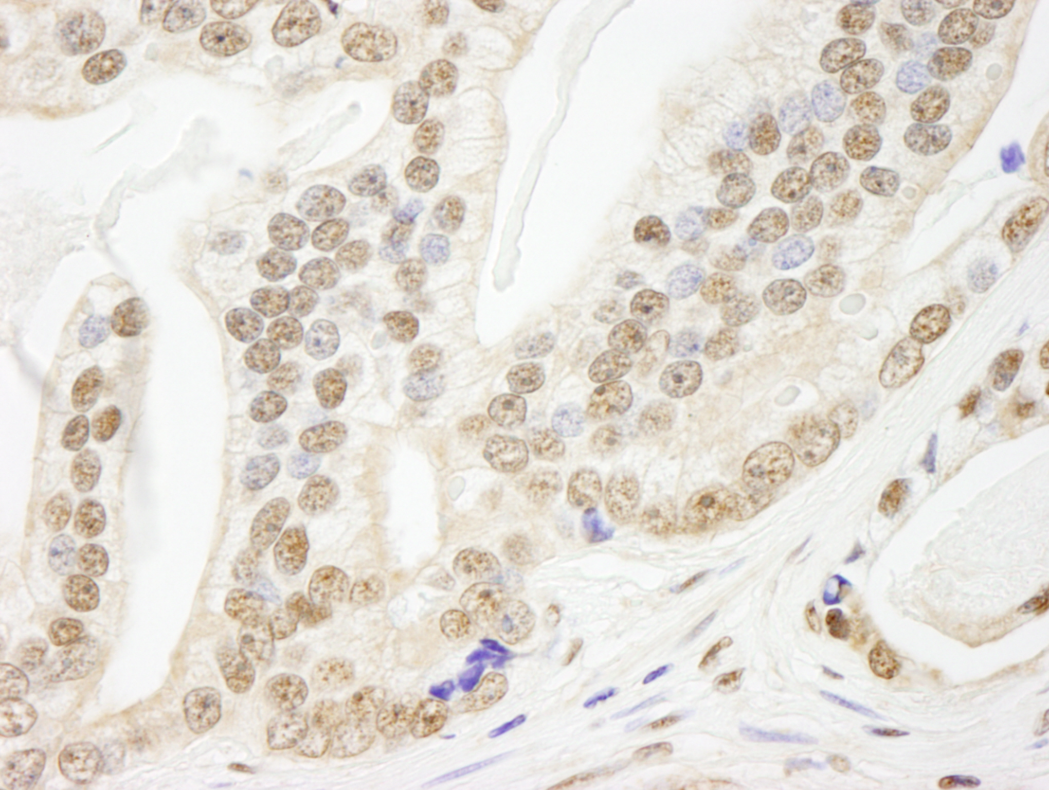 Rabbit anti-Pds5B IHC Antibody