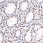 Detection of human ZFP106 by immunohistochemistry.