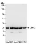 Detection of human and mouse LSM12 by western blot.