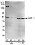 Detection of human and mouse WDR12 by western blot.
