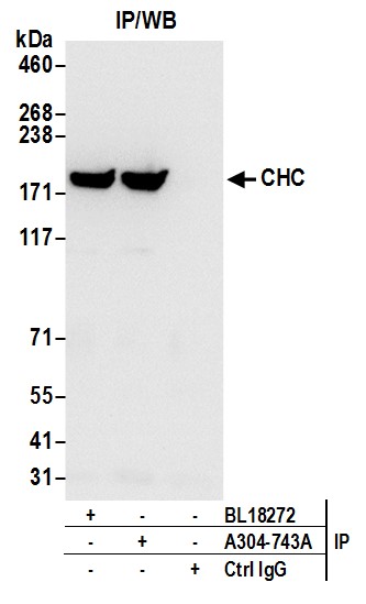 Detection of human CHC by western blot of immunoprecipitates.