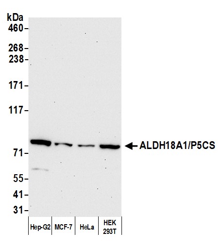 Detection of human ALDH18A1/P5CS by western blot.