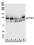 Detection of human and mouse FTSJ3 by western blot.