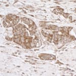 Detection of human TRAP1/HSP75 by immunohistochemistry.