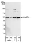 Detection of human PABPN1 by western blot.