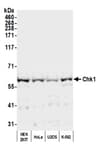 Detection of human Chk1 by western blot.