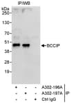 Detection of human BCCIP by western blot of immunoprecipitates.