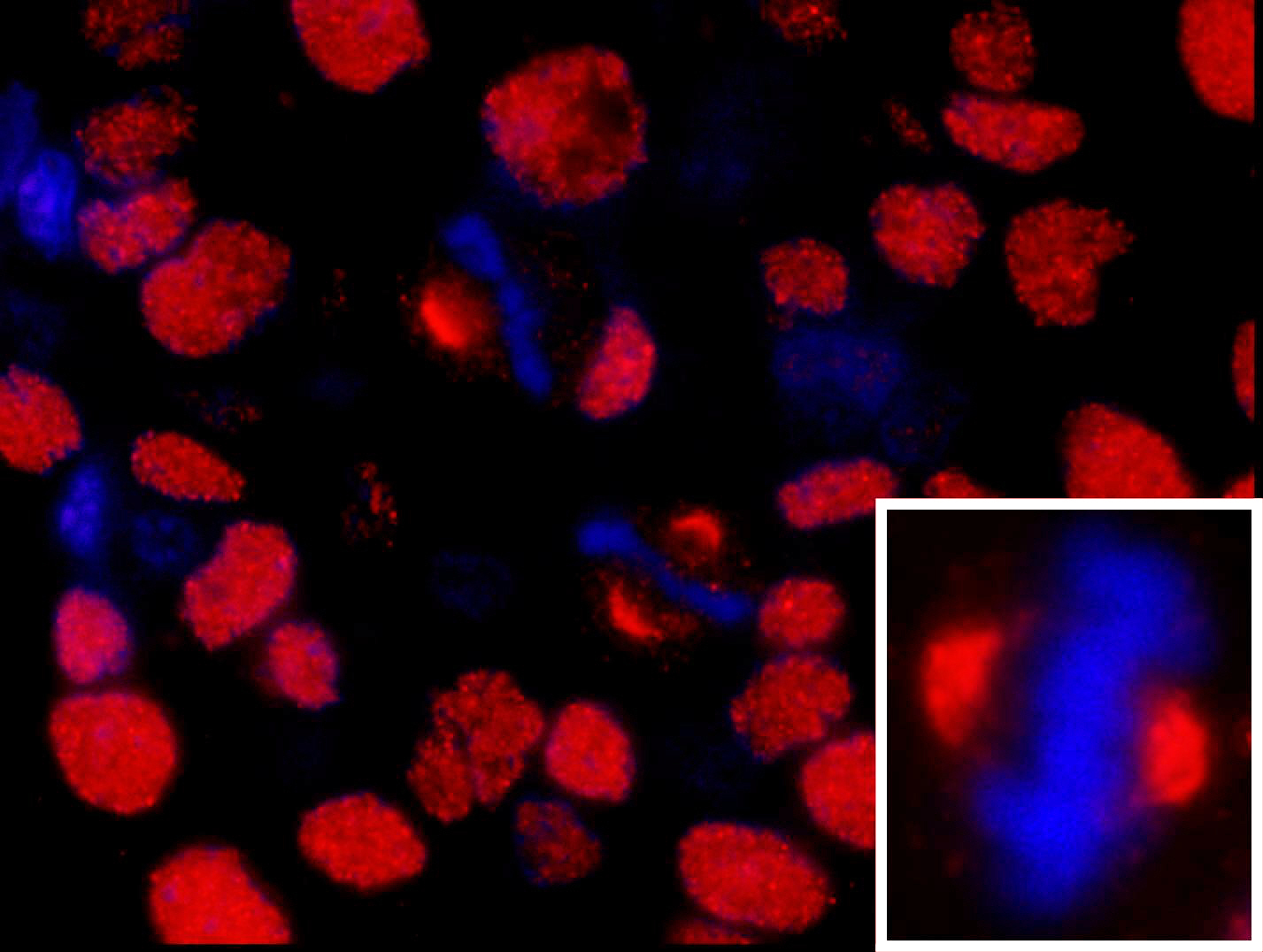 Rabbit anti-NUMA IHC Antibody