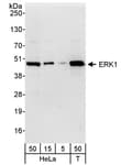Detection of human ERK1 by western blot.