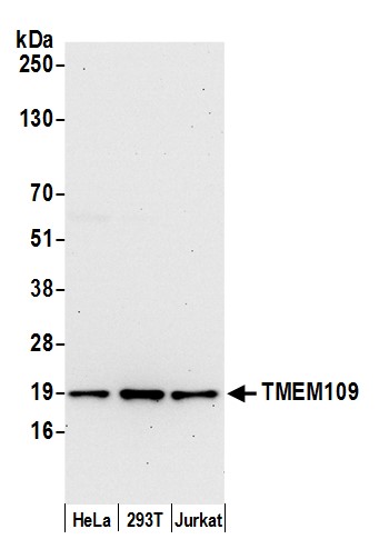 Detection of human TMEM109 by western blot.