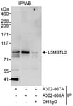 Detection of human L3MBTL2 by western blot of immunoprecipitates.