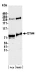 Detection of human EYA4 by western blot.